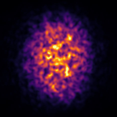 Energy released in the first instant of an off-center gold–gold collision, from one of our simulations. Each bright knot is a tangle of the glasma, the strongest force fields known in nature.